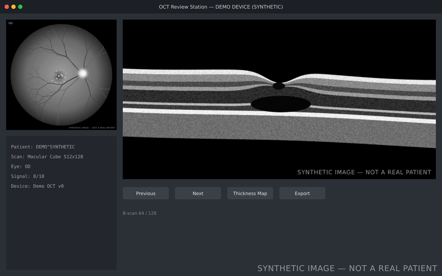 Synthetic OCT review workstation screen with a macular scan