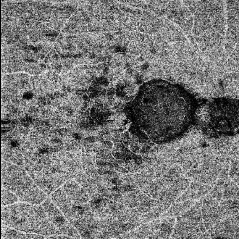 OCT angiography en face image